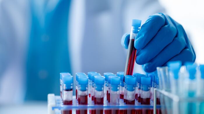 Blood disorder