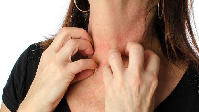 Woman scratching neck
