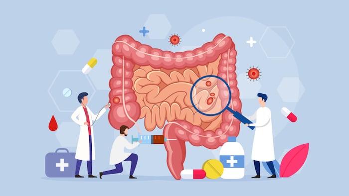 Modern process Intestinal inner organs disease treatment design concept with Tiny People