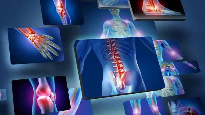 Human joints