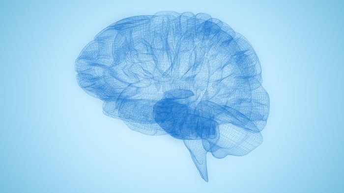 hunter syndrome brain