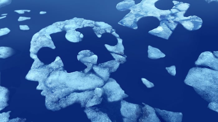 Brain cloud jigsaw