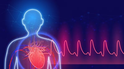 AliveCor Breakthrough:  AI-Powered ECG Systems Cleared To Detect 35 Life-Threatening Cardiac Conditions
