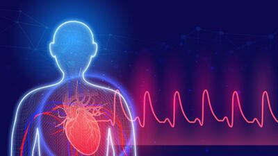 AliveCor Breakthrough: AI-Powered ECG Systems Cleared To Detect 35 Life-Threatening Cardiac Conditions