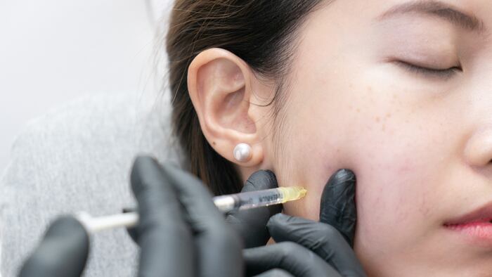 A gloved hand injects a dermal filler into the cheek of an Asian woman.