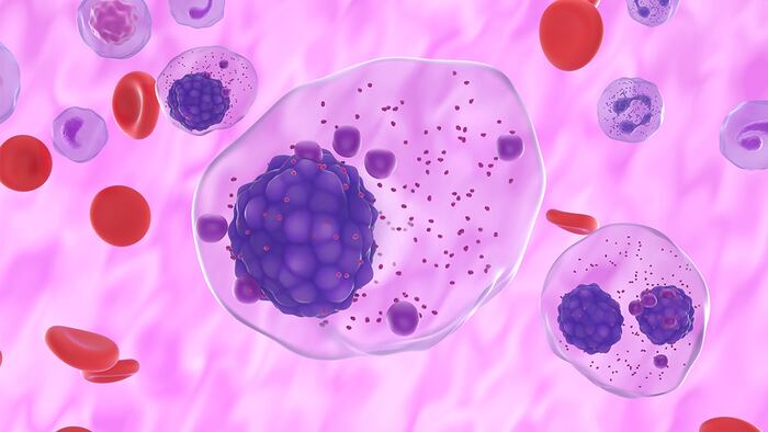 multiple myeloma