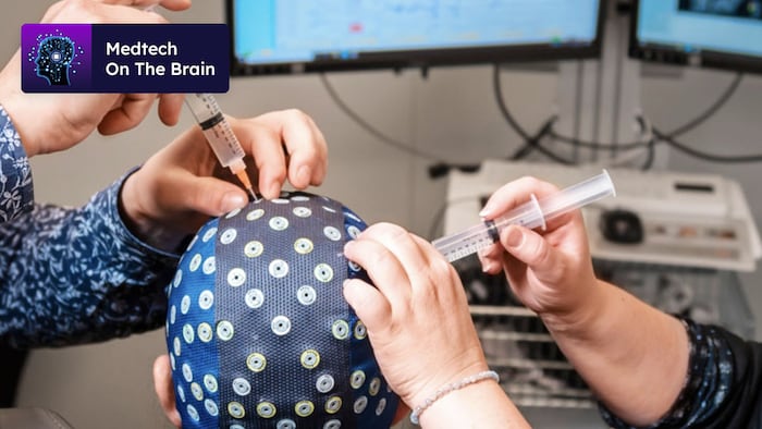 DeepPSY EEG service