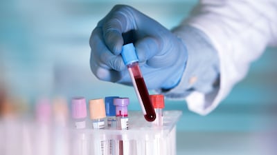 Guardant’s FDA Approval For Colorectal Cancer Blood Test, Paves Road To Potential Medicare Coverage