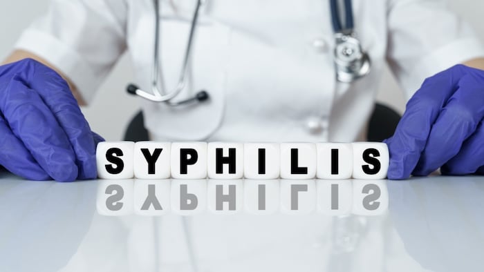 Syphilis Test