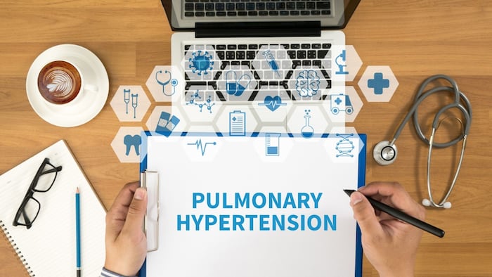 PULMONARY HYPERTENSION Top view, Doctor writing medical records on a clipboard, medical equipment