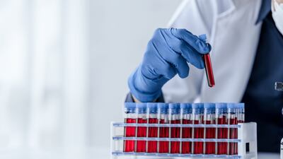 EU Substances Of Human Origin Regulation Set To Pass Final Milestones