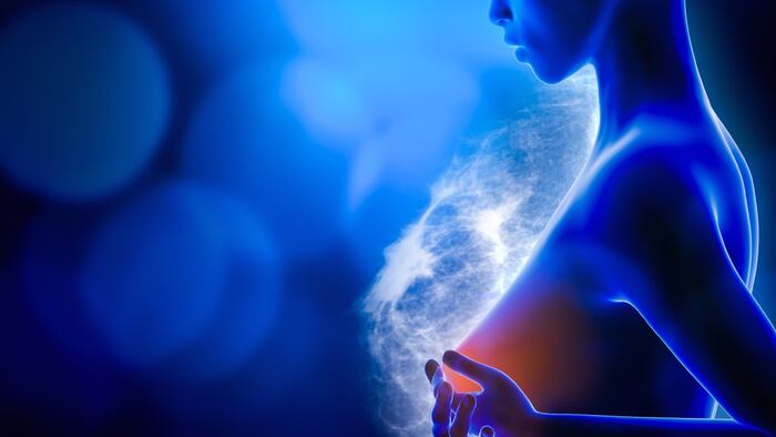 Image of blue woman with red circle in breast, representing breast cancer