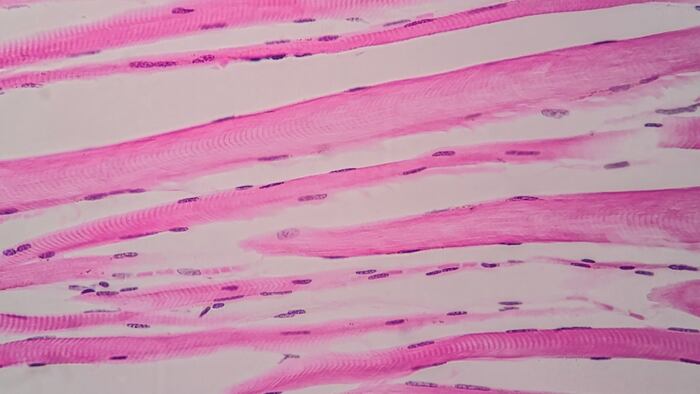 Skeletal_Muscle