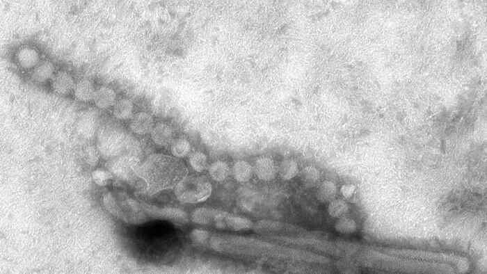Influenza A H7N9