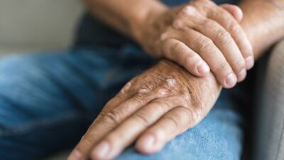 EMA Seeks Input on Modernizing 17-Year-Old Psoriatic Arthritis Guide