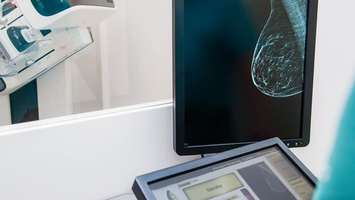 Mammogram snapshot of breasts of a female patient on the monitor with undergoing mammography test on the background. Selective focus