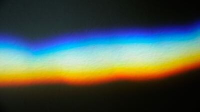 SpectralMD Has Developed A Breakthrough Tool For Wound Healing