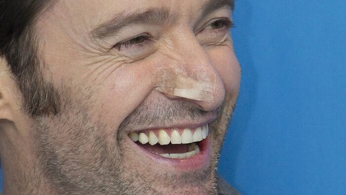 High_Jackman