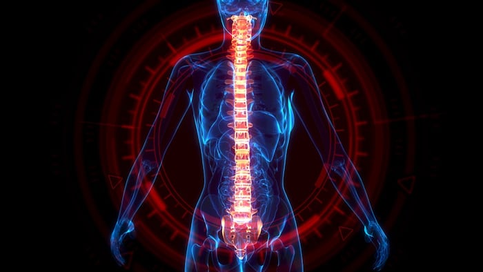 xray