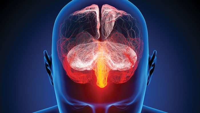 Human brain illustrated with millions of small nerves - Conceptual 3d render