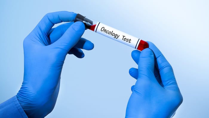 Liquid biopsy