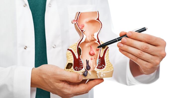 Treatment Rectal Diseases