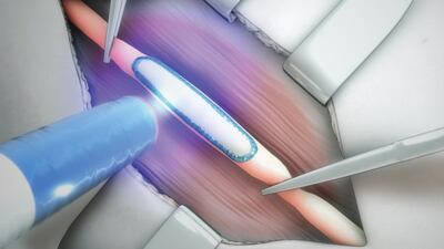Tissium Hopes Its Programmable Polymer Will Be A Gamechanger For Nerve Repair
