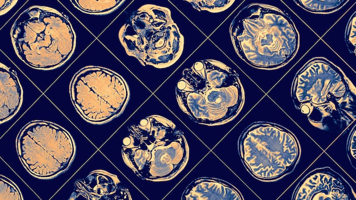 MR image of Human brain