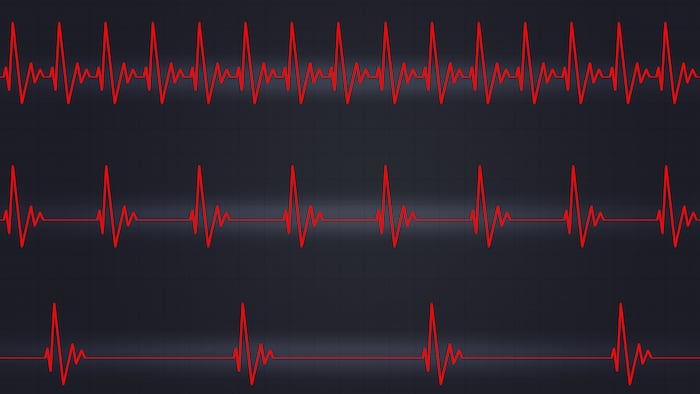 medicine illustration of heart pulsating fast normal and slow