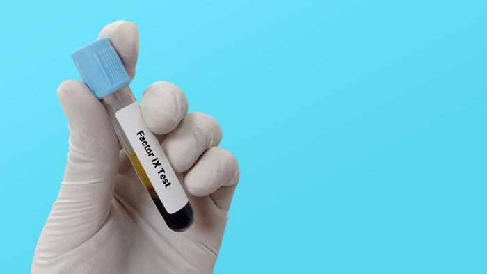 Factor IX