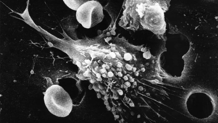 Cancer cells
