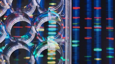 GB-Business-Free: ‘Analysis’ article that includes different Composer content