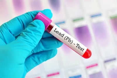 GB-Policy&Regulation (Premium-1): Lead Exposure Is Still a Problem for Kids, and the Pandemic Has Made It Worse