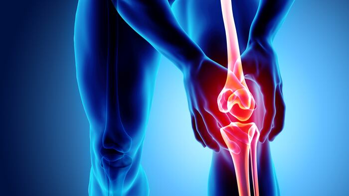 Knee painful - skeleton x-ray, 3D Illustration medical concept