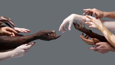 UK Trial Inclusion And Diversity Plans To Have ‘Wider Scope’ Than Those In US