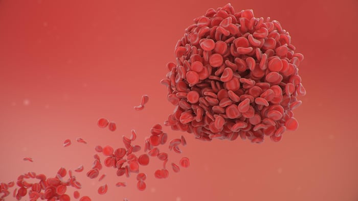 Red blood cells joining together to form a blood clot.