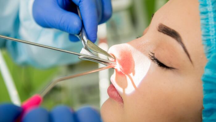 Doctor performs endoscopic sinus surgery on a young woman.